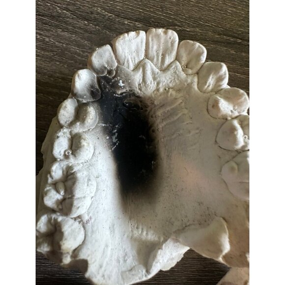 Vintage Dental Teeth Mold Cast – Upper & Lower Set - Picture 6 of 11